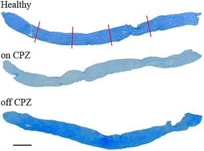 Visual Evoked Potentials to Monitor Myelin Cuprizone-Induced Functional Changes